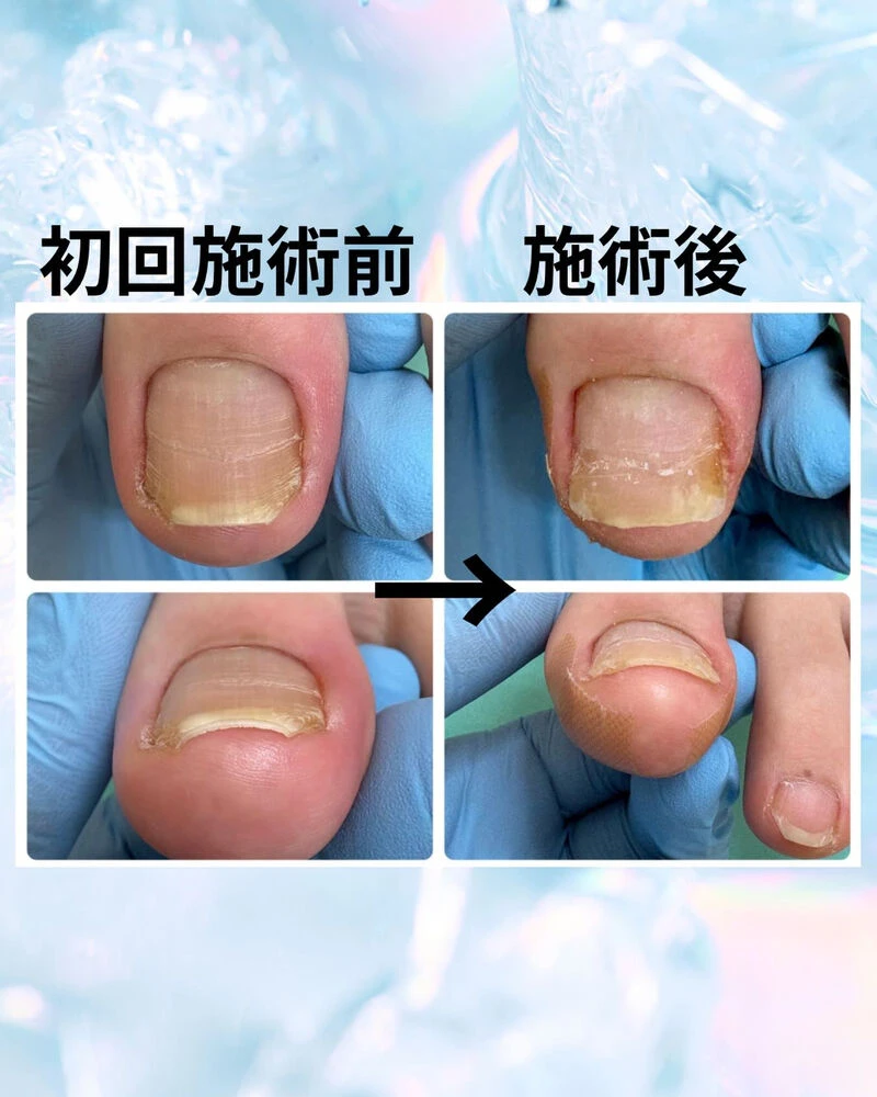 ブログ画像