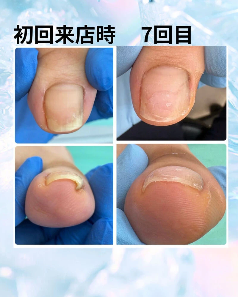 ブログ画像