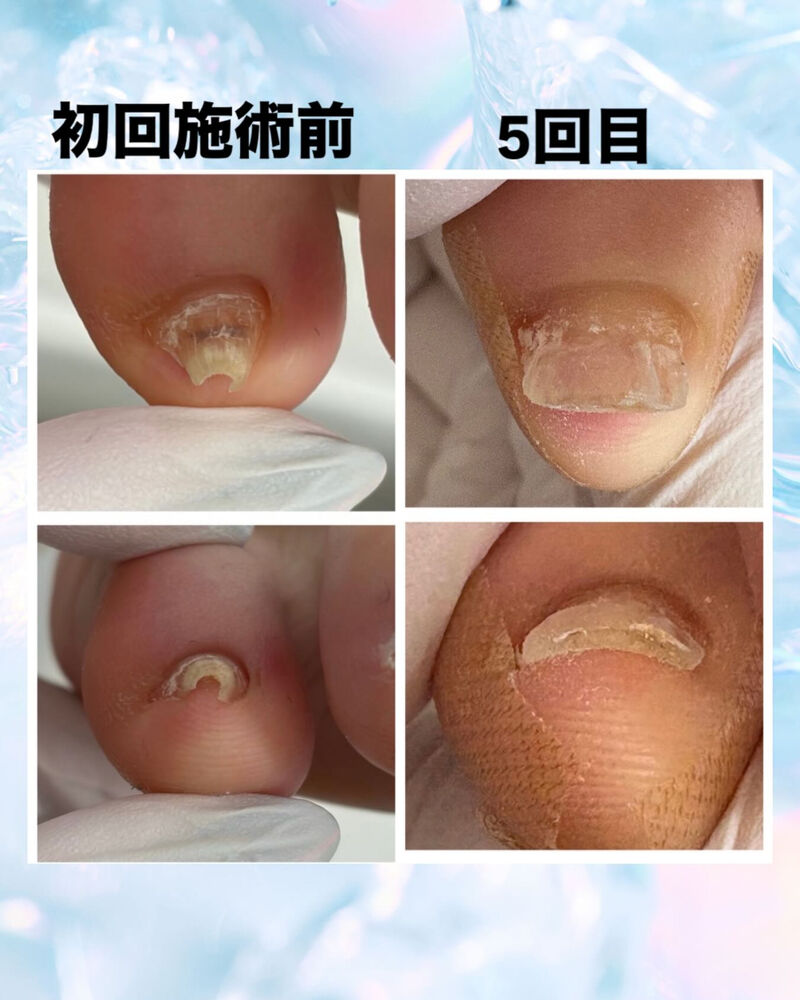 ブログ画像