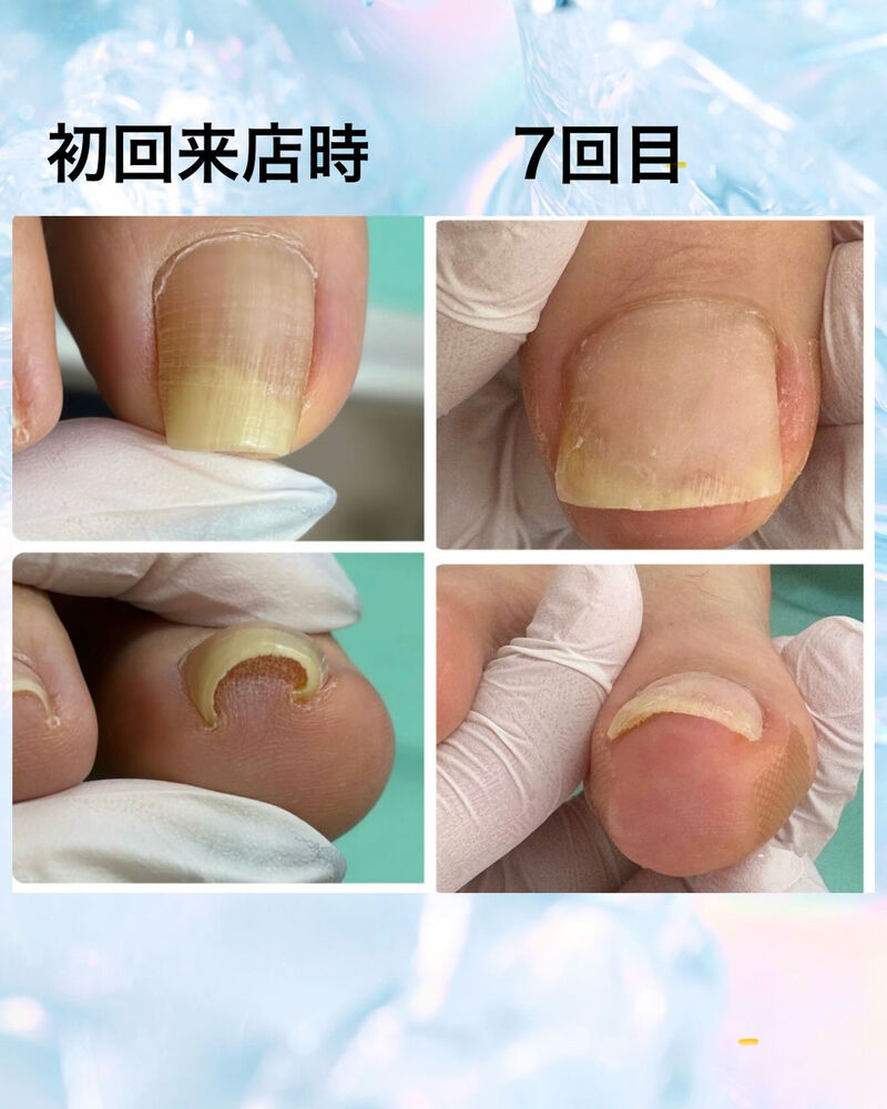ブログ画像