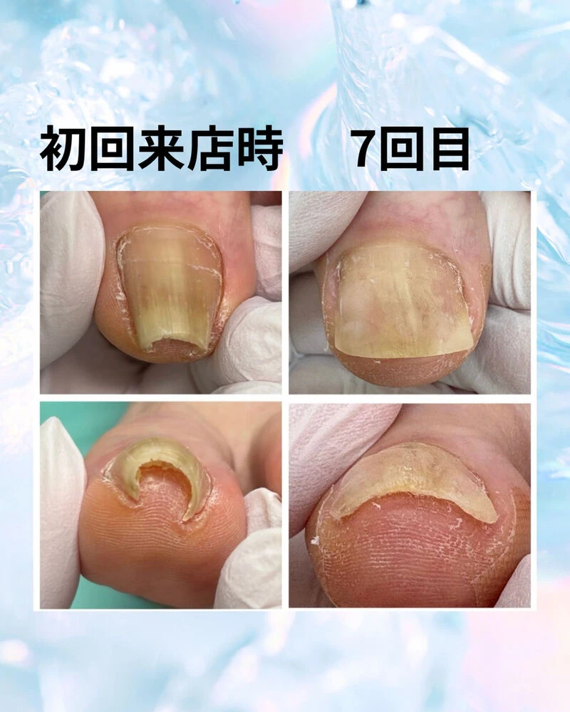 ブログ画像